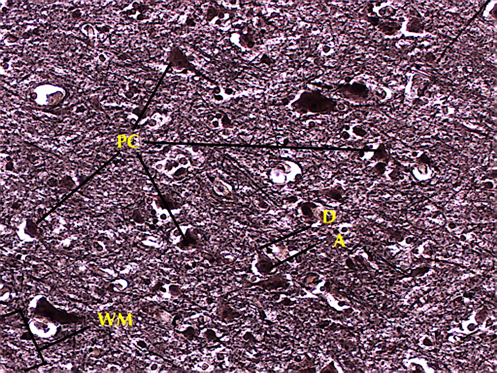 Cerebral Cortex Histology Layers